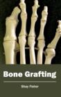 Bone Grafting - Book