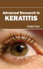 Advanced Research in Keratitis - Book