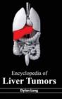 Encyclopedia of Liver Tumors - Book