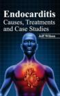 Endocarditis: Causes, Treatments and Case Studies - Book
