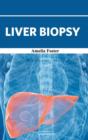 Liver Biopsy - Book