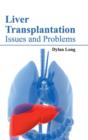 Liver Transplantation: Issues and Problems - Book