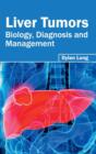 Liver Tumors: Biology, Diagnosis and Management - Book