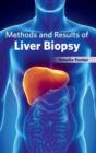Methods and Results of Liver Biopsy - Book