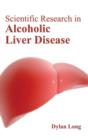 Scientific Research in Alcoholic Liver Disease - Book