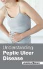 Understanding Peptic Ulcer Disease - Book