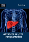 Advances in Liver Transplantation - Book