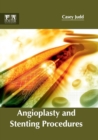 Angioplasty and Stenting Procedures - Book