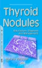 Thyroid Nodules : Risk Factors, Diagnosis and Management - eBook