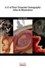 A-Z of First Trimester Sonography Atlas & Illustration - Book
