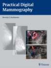 Practical Digital Mammography - eBook
