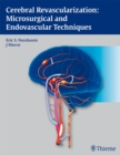 Cerebral Revascularization: Microsurgical and Endovascular Techniques - eBook