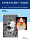 Skull Base Cancer Imaging : The Practical Approach to Diagnosis and Treatment Planning - eBook