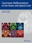 Cavernous Malformations of the Brain and Spinal Cord - eBook