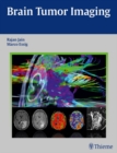 Brain Tumor Imaging - eBook