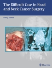 The Difficult Case in Head and Neck Cancer Surgery - eBook