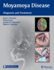 Moyamoya Disease : Diagnosis and Treatment - eBook