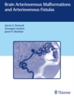 Brain Arteriovenous Malformations and Arteriovenous Fistulas - eBook