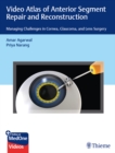 Video Atlas of Anterior Segment Repair and Reconstruction : Managing Challenges in Cornea, Glaucoma, and Lens Surgery - eBook