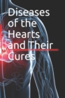 Diseases of the Hearts and Their Cures - Book