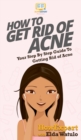 How To Get Rid of Acne : Your Step By Step Guide To Getting Rid of Acne - Book