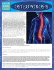 Osteoporosis (Speedy Study Guide) - Book