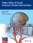 Video Atlas of Acute Ischemic Stroke Intervention - Book