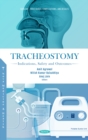 Tracheostomy: Indications, Safety and Outcomes - eBook