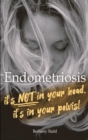 Endometriosis : it's not in your head, it's in your pelvis - Book