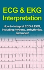 ECG & EKG Interpretation : How to interpret ECG & EKG, including rhythms, arrhythmias, and more! - eBook