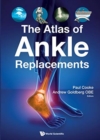 The Atlas of Ankle Replacements - Book