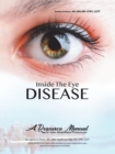 Inside the Eye Disease Just the Facts : A Resource Manual for the Vision Rehabilitation Professionals - eBook