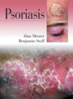 Psoriasis - Book