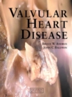 Valvular Heart Disease - Book