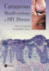 Cutaneous Manifestations of HIV Disease - Book