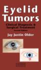 Eyelid Tumors - eBook
