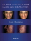 Ablative and Non-ablative Facial Skin Rejuvenation - Book