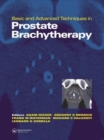 Basic and Advanced Techniques in Prostate Brachytherapy - Book