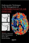 Endovascular Techniques in the Management of Cerebrovascular Disease - Book