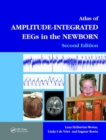 An Atlas of Amplitude-Integrated EEGs in the Newborn - Book