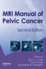 MRI Manual of Pelvic Cancer,Second Edition - eBook