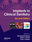 Implants in Clinical Dentistry - Book