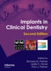 Implants in Clinical Dentistry - eBook