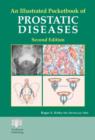 An Illustrated Pocketbook of Prostatic Disease - Book