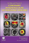 An Atlas and Manual of Coronary Intravascular Ultrasound Imaging - Book
