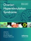 Ovarian Hyperstimulation Syndrome - Book