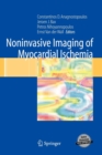 Noninvasive Imaging of Myocardial Ischemia - Book