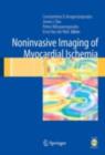 Noninvasive Imaging of Myocardial Ischemia - eBook