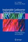 Implantable Cardioverter Defibrillator Stored ECGs : Clinical Management and Case Reports - eBook