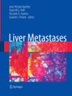 Liver Metastases - Book